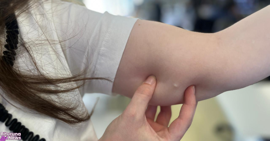 Procura por implante contraceptivo no SUS do Paraná cresce 118% em 2025