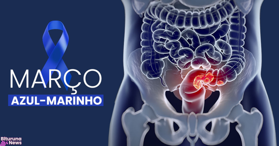 Exames para detectar câncer de intestino triplicam no SUS na última década