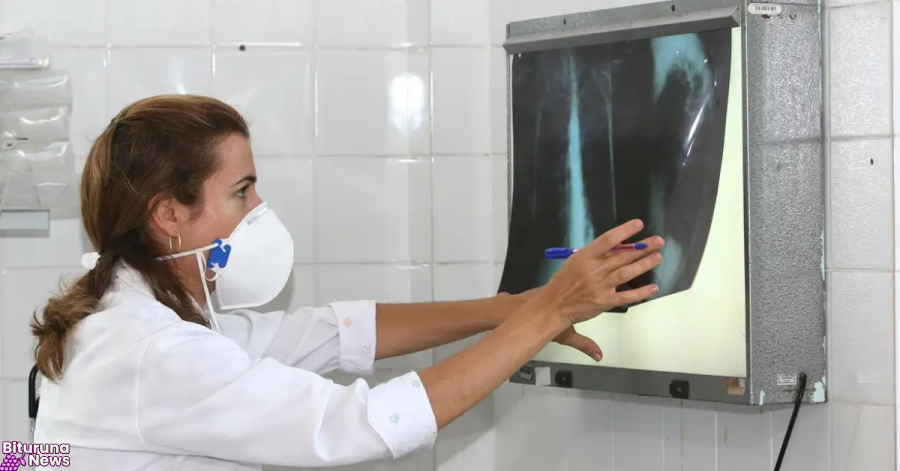 OMS recomenda testes de diagnóstico rápido para erradicar tuberculose